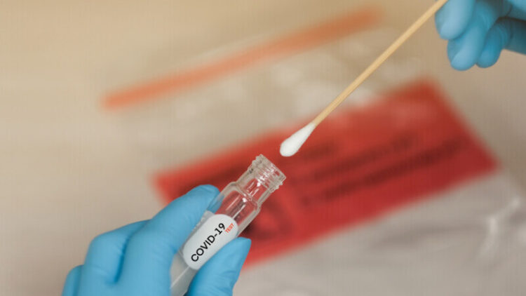 Bilanț coronavirus, 30 iulie 2022. Peste 7.500 de cazuri noi și 20 de decese, în ultimele 24 de ore
