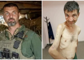 Schimbarea dramatică a unui erou de la Azovstal. Cum arată un soldat înainte și după eliberarea din captivitatea rusă | FOTO