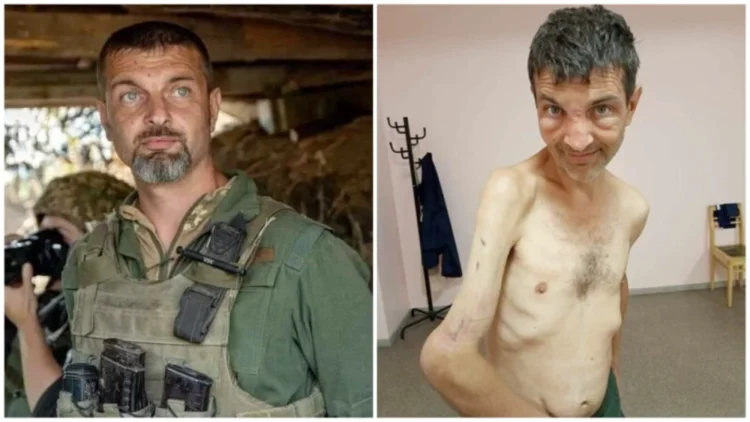 Schimbarea dramatică a unui erou de la Azovstal. Cum arată un soldat înainte și după eliberarea din captivitatea rusă | FOTO