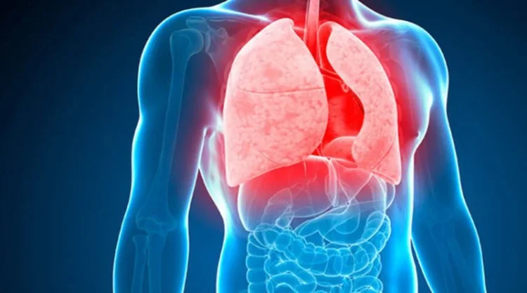 O boală pe care mulți o confundă cu răceala se răspândește în România. Medicii avertizează că lângă un bolnav pot fi alți 10 infectați