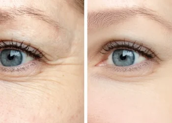 Retinoizii – tipuri, beneficii si mod de utilizare