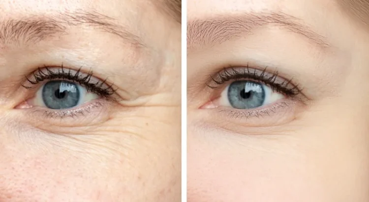 Retinoizii – tipuri, beneficii si mod de utilizare