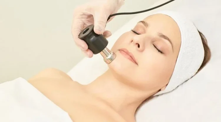 Rejuvenarea pielii cu laser CO2