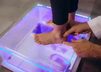 Deformarile piciorului in populatia pediatrica