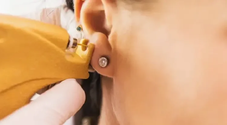 Tratamentul infectiilor asociate piercing-ului