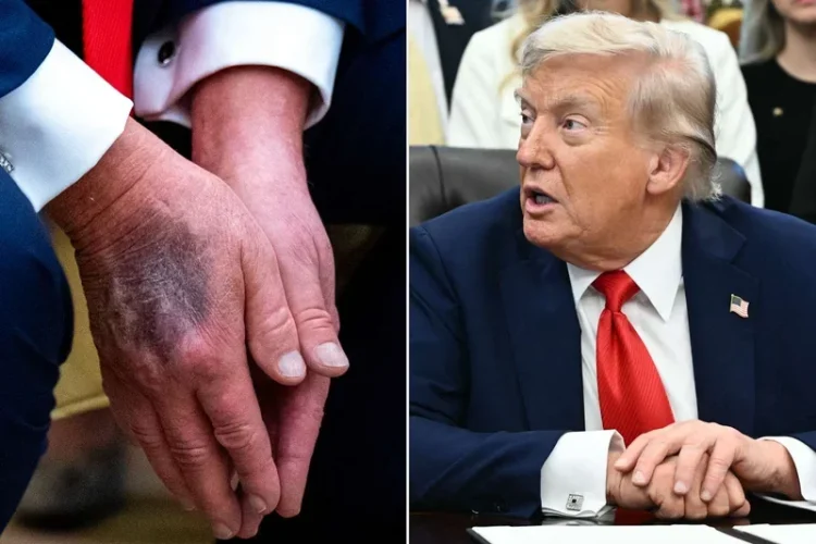 WSJ: Cum se luptă Trump cu vârsta: doze mari de aspirină, machiaj pentru mâini, somn puțin și hamburgeri. „Am gene bune”